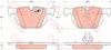 Okładziny (klocki) do hamulców tarczowych tylne GDB1727 TRW