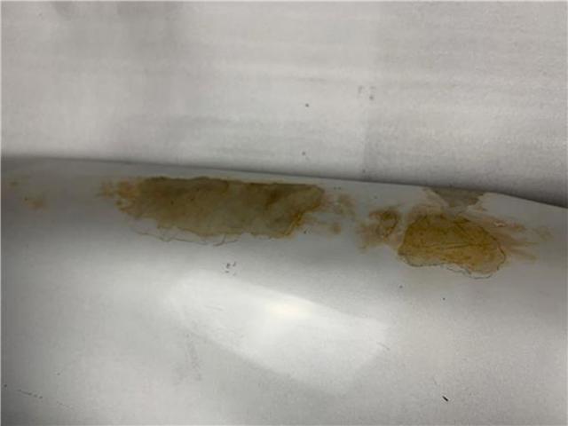 Błotnik przedni lewy Citroen Berlingo M