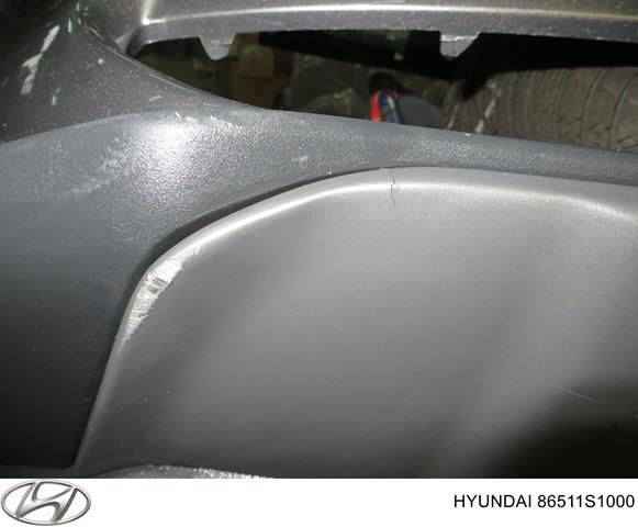 Osłona zderzaka przedniego Hyundai/Kia 86577S1000 cena, od 52,08 USD