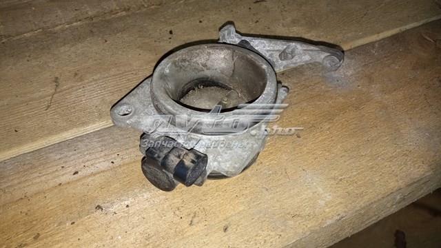 161192787R Renault (RVI) Przepustnica, komplet